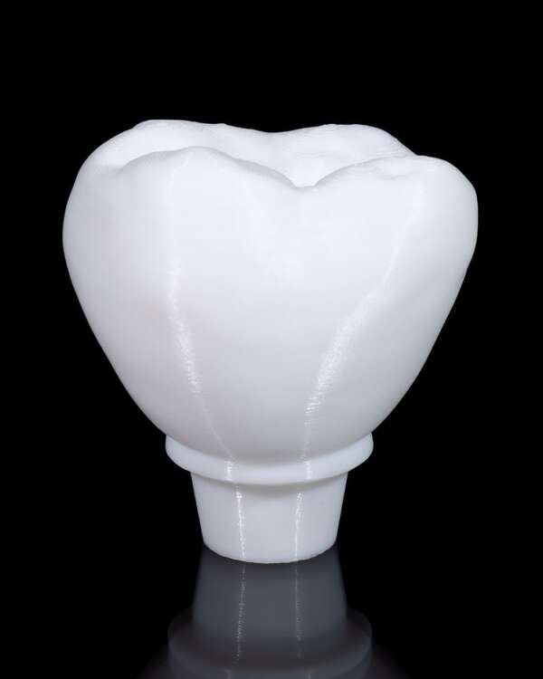 Machetă anatomică Implant Dentar - imagine 2