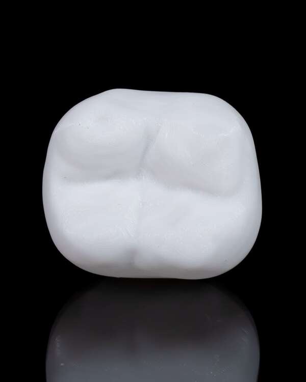 Machetă anatomică Implant Dentar - imagine 3