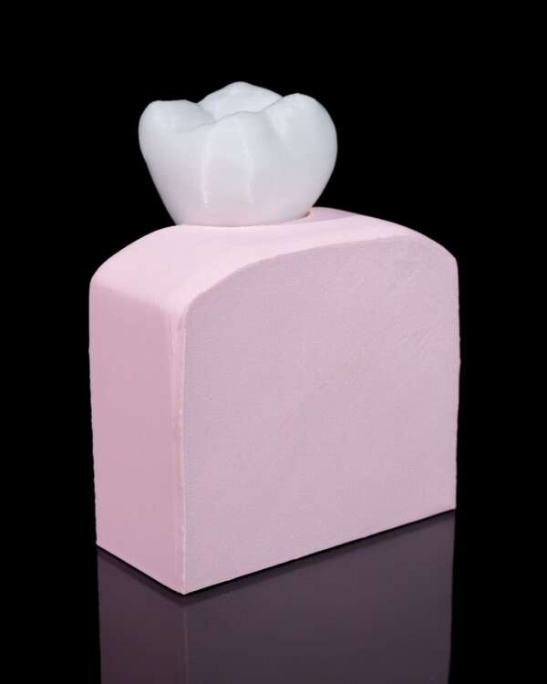 Machetă anatomică Implant Dentar - imagine 4